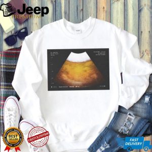 Funny Beer Ultrasound Pregnancy Announcement T shirt Funny Beer Ultrasound Pregnancy Announcement T shirt